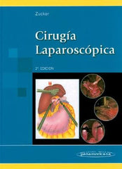 Cirugía Laparoscópica