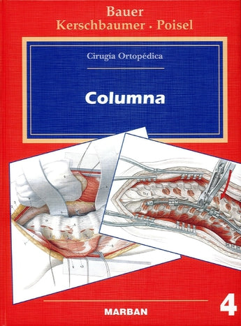 Bauer - Cirugía Ortopédica - Columna   Vol. 4