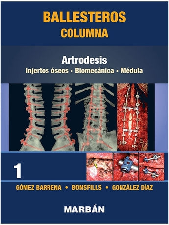 Columna Tomo 1: Artrodesis