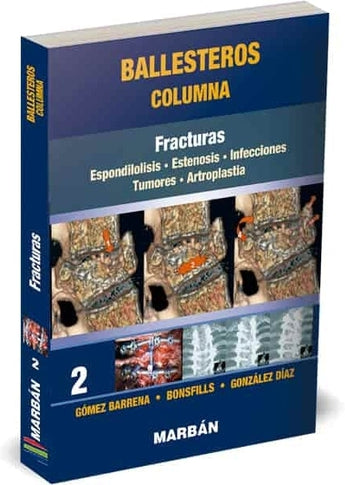 Columna Tomo 2: Fracturas