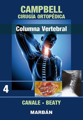 Cirugía Ortopédica - Columna Vertebral