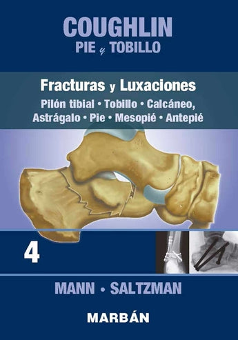 Coughlin - Pie y Tobillo 4. Fracturas y Luxaciones. Pilón Tibial. Tobillo. Calcáneo. Pie.