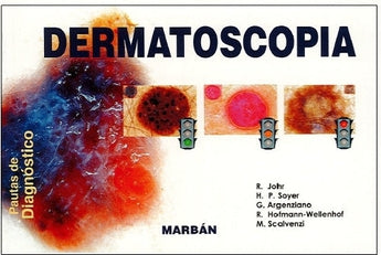 Dermatoscopia. Oautas de diagnóstico