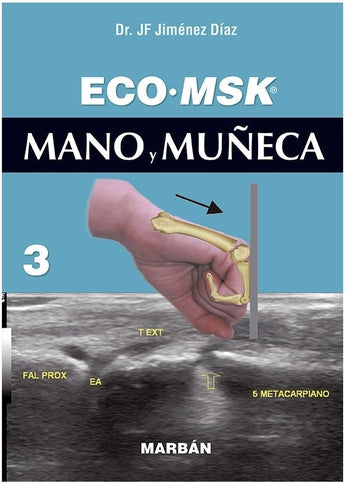 Eco MSK 3 Mano y Muñeca