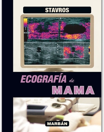 Ecografía de Mama