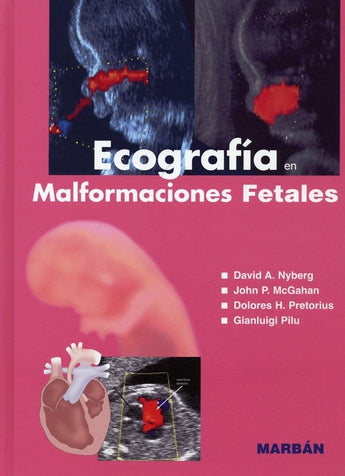 Ecografía en Malformaciones Fetales