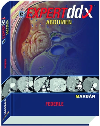 Expert DDX Abdomen - Amirsys