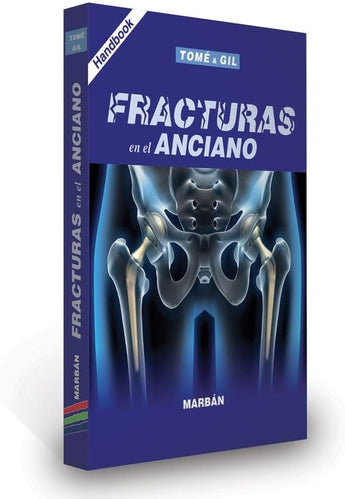 Fracturas en el Anciano - Handbook