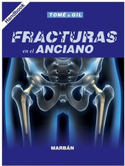 Fracturas en el Anciano - Handbook