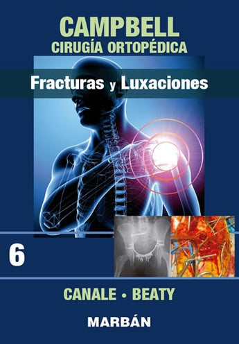 Cirugía Ortopédica - Fracturas y Luxaciones. Tomo 6