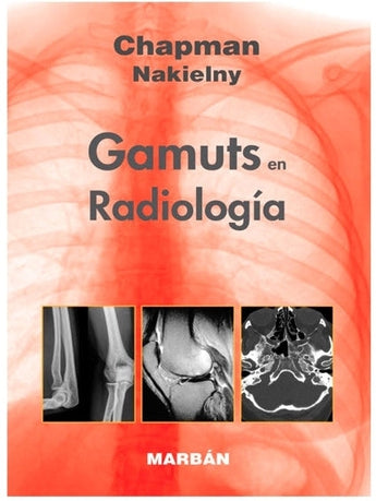 Gamuts en Radiología