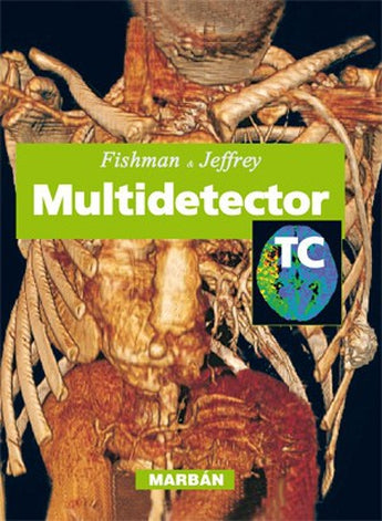 Multidetector TC