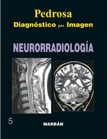 Diagnóstico por imagen - Neurorradiología - Pedrosa