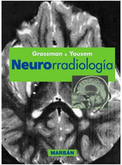 Neurorradiología