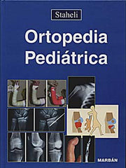 Ortopedia Pediátrica