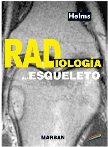 Fundamentos de Radiología del Esqueleto