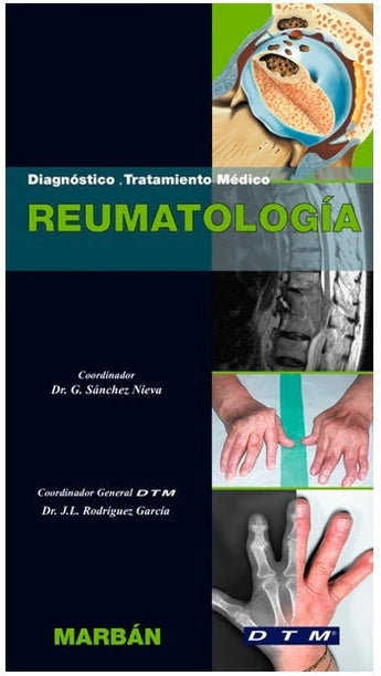 Diagnóstico y Tratamiento Medico - Reumatología