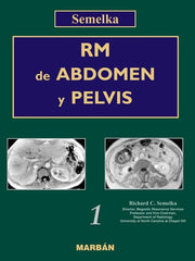 RM de Abdomen y Pelvis, 2 Vols