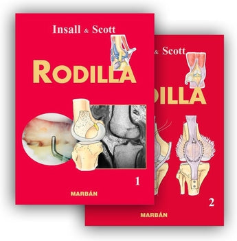 Rodilla