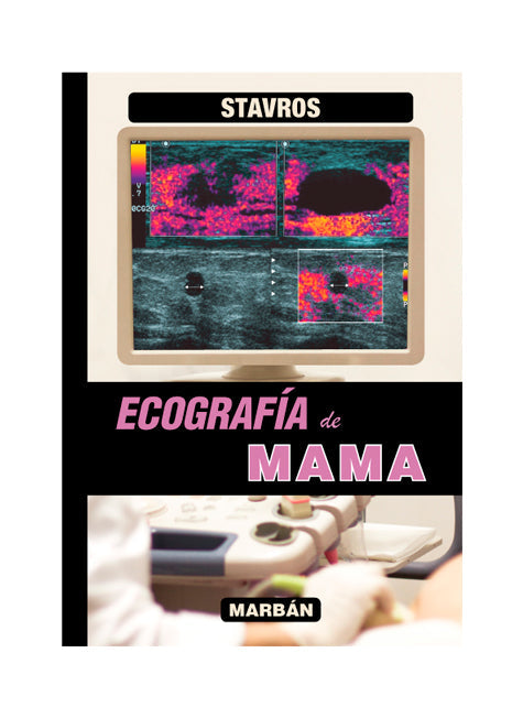 Ecografía de Mama - Stavros 