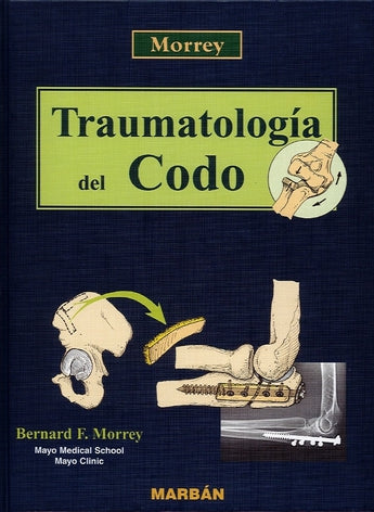 Traumatología del Codo - Mayo Clinic