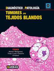 Tumores en tejidos blandos