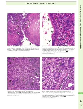 ampolla de vater histología